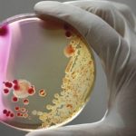 Australia Sepsis Study