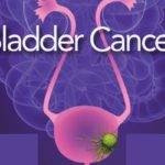 Bladder Cancer