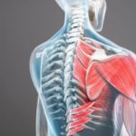 CAR-T-muscle-inflammation