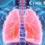 Cystic Fibrosis