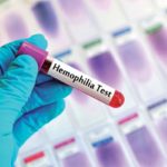 Haemophilia