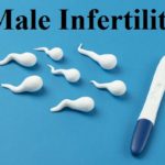 Male Infertility