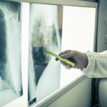 Personalised Immunotherapy