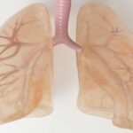 Progressive Pulmonary Fibrosis