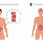 Stress And Gut Health How Are They Related1
