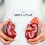 kidney-cancer