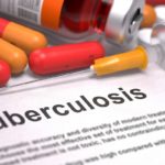 tuberculosis