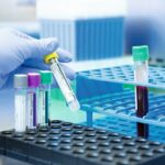 QuantiFERON-TB Gold Plus