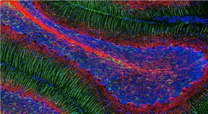 Considerations for Purchasing Antibodies