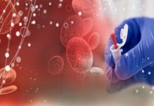 Dicerna, Novo Nordisk sign RNAi deal for liver-related cardio-metabolic diseases
