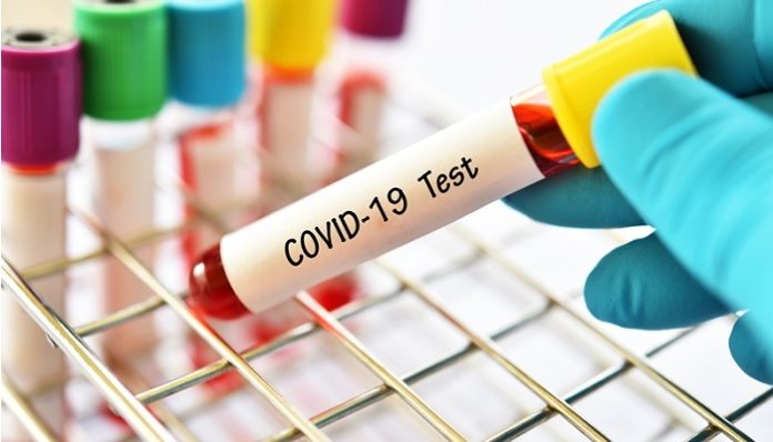 Novavax Awarded Funding from CEPI for COVID-19 Vaccine Development