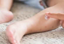Pfizer Wins New Pediatric Approval for Atopic Dermatitis Ointment Eucrisa