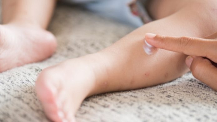 Pfizer Wins New Pediatric Approval for Atopic Dermatitis Ointment Eucrisa