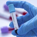 Roche develops new serology test to detect COVID-19 antibodies