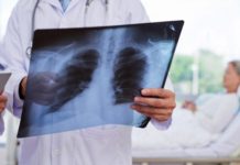 Untreatable Lung Cancer Patients Get Breakthrough Treatment