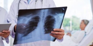 Untreatable Lung Cancer Patients Get Breakthrough Treatment