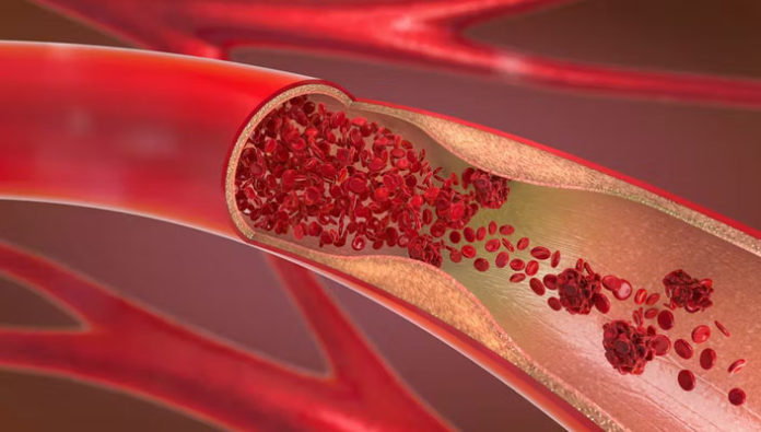 Blood Vessel Breakthrough Helps Treatment of Alzheimers