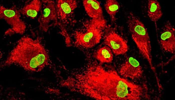 The Ratio of NA To NAM As A Test For Cell Therapy Sterility