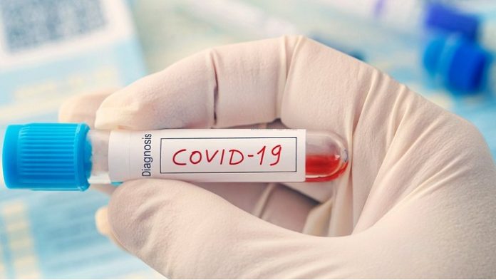 Chembio Announces Launch of DPP COVID-19 Serological Point-of-Care Test