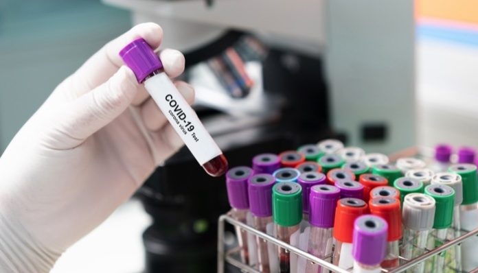Eagle Pharma Announces Laboratory Test Results Demonstrating In Vitro Antiviral Activity of RYANODEX Against Coronavirus SARS-CoV-2